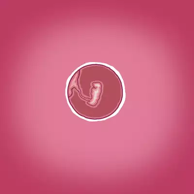 Yumi's Study Abroad/由美的留学生活（汉化）（连载中）