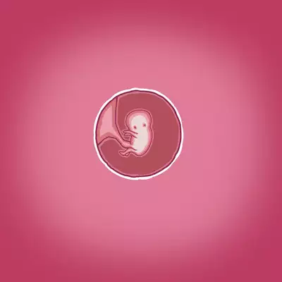 Yumi's Study Abroad/由美的留学生活（汉化）（连载中）