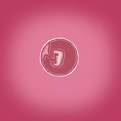 Yumi's Study Abroad/由美的留学生活（汉化）（连载中）